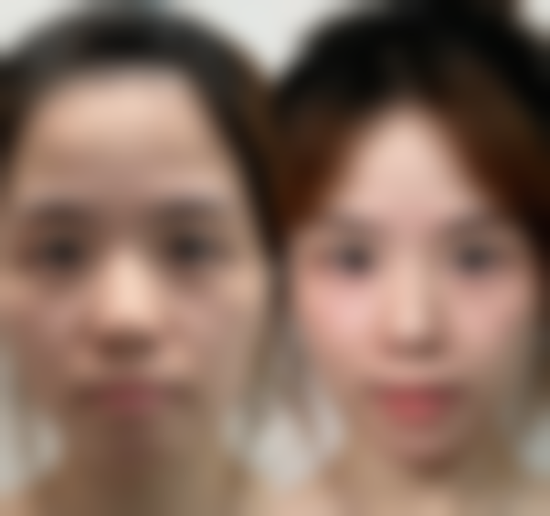 攀枝花大华医学美容医院正规吗？