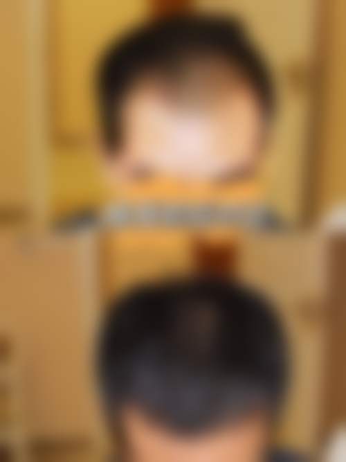 郑州悦美美容医院口碑好不好？附真实患者口碑评价