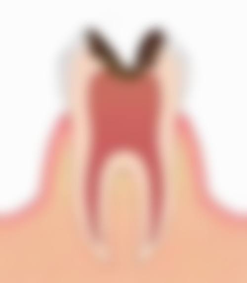 赤峰于国占齿美口腔诊所擅长项目。