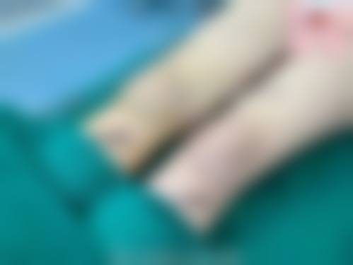 蚌埠康美整形美容擅长项目。