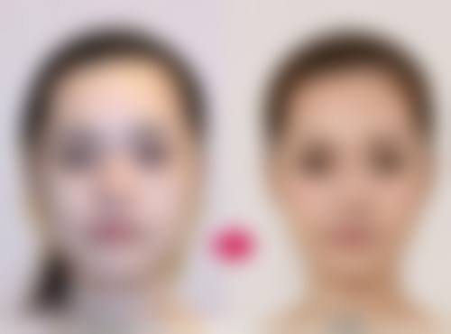 大连维恩医疗美容口碑评价怎么样?