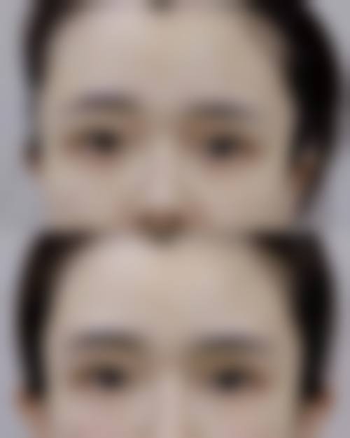 沈阳睿丽艺美整形医院擅长项目。