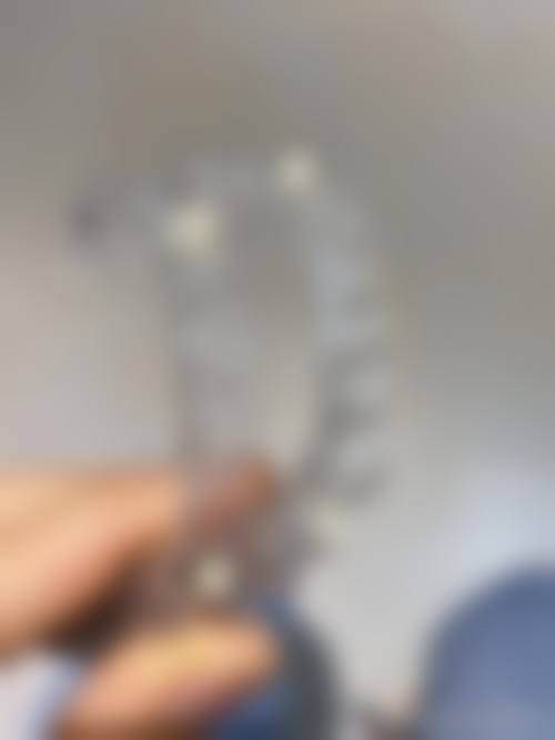 常熟安澜口腔门诊部治疗反馈与口碑评价。
