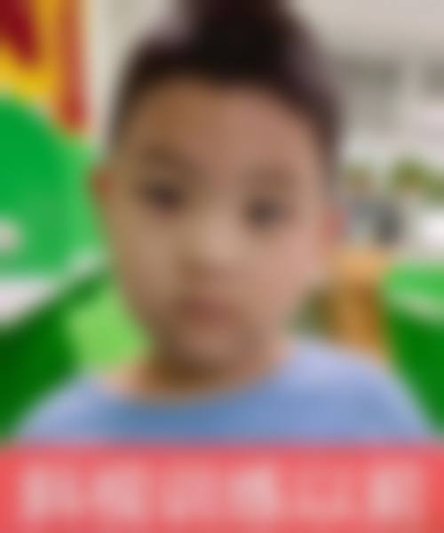 大连爱尔马桥眼科诊所治疗反馈与口碑评价。