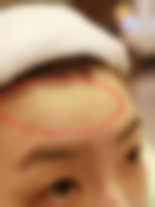 乐山美安心医疗美容诊所治疗反馈与口碑评价。