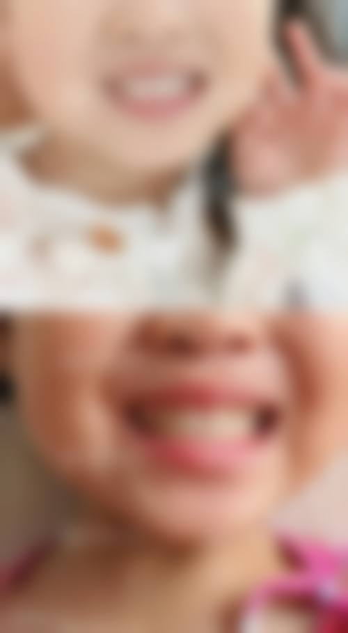 林佳瑞医生的技术实力