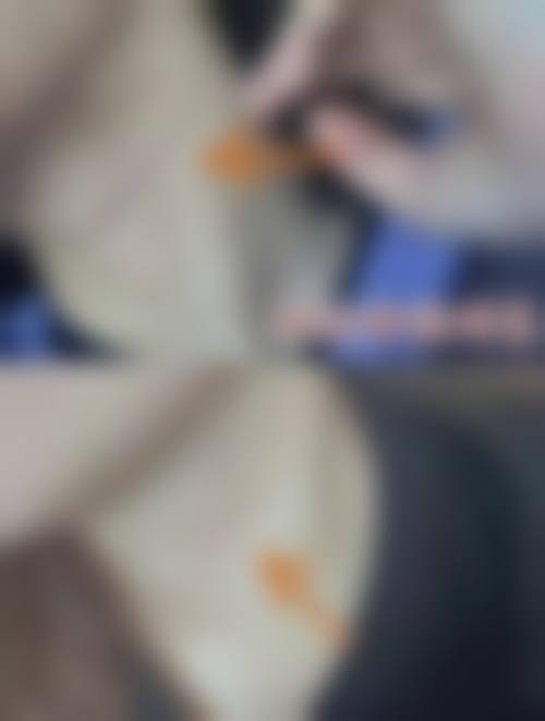广州雅致整形医院擅长项目。