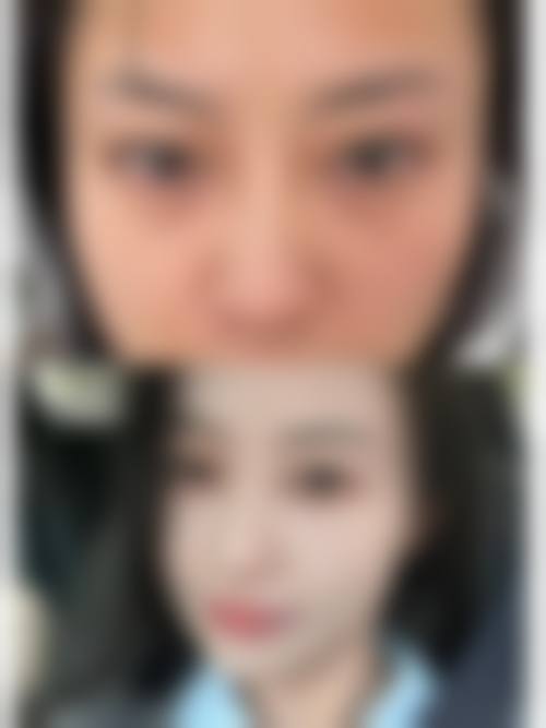 石家庄诚楠痤疮医疗美容诊所治疗反馈与口碑评价。