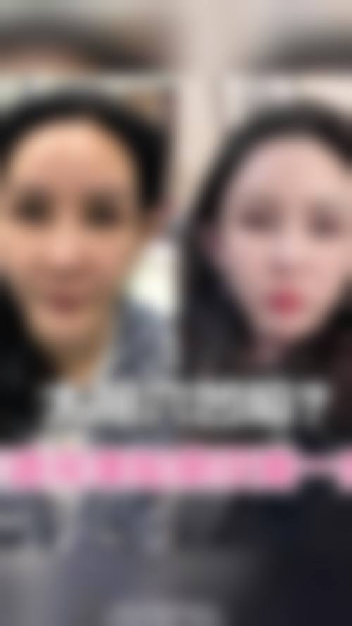 石家庄诚楠痤疮医疗美容诊所擅长项目。