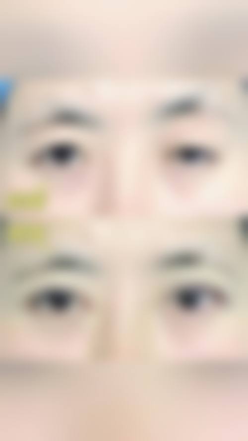 达川区人民医院眼科擅长项目。