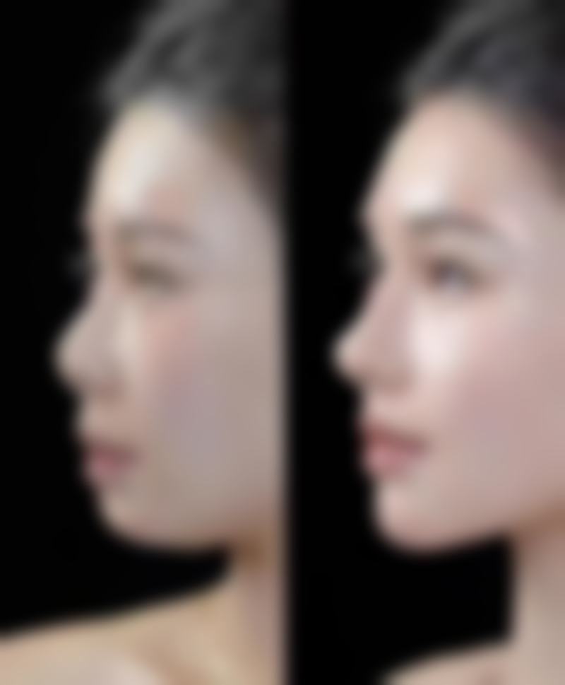 福州博美医疗整形美容机构口碑评价怎么样？