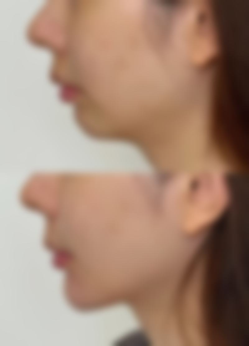 高原辰技术或实力