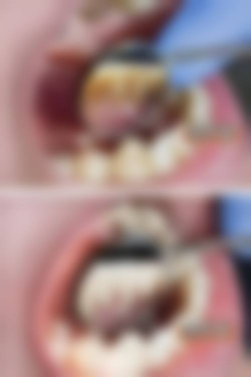 常州谐禾口腔门诊部口碑评价