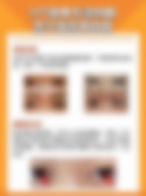 湖北省第三人民医院眼科门诊营业时间。
