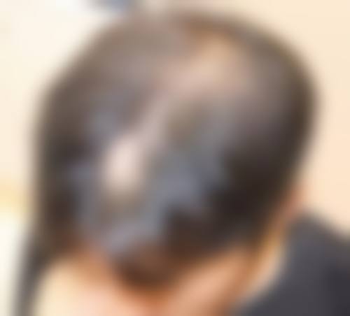 枣庄华美丽妍医疗美容诊所治疗反馈与口碑评价。