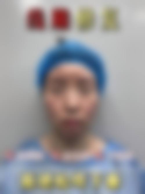 福州莎菲琳弘宇整形医院预约挂号方式