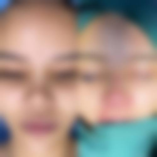 长春华美整形美容医院治疗反馈与口碑评价