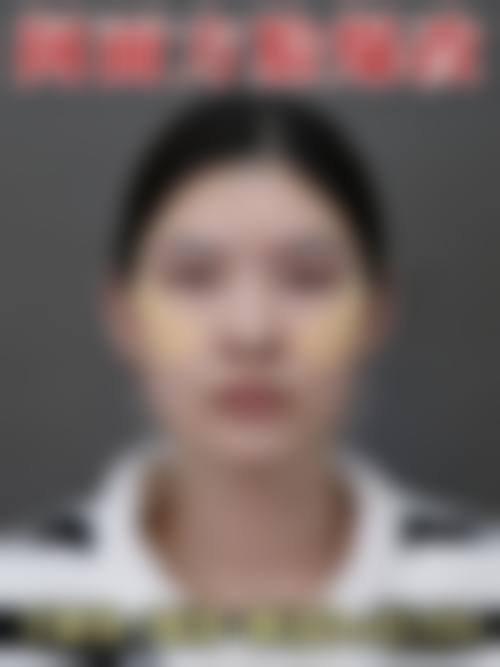 枣庄华美丽妍医疗美容诊所擅长项目。