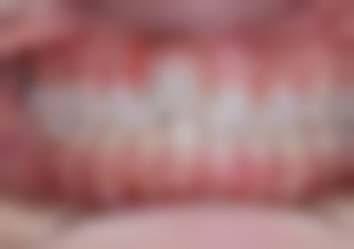 深圳洁丰口腔诊所预约挂号方式。