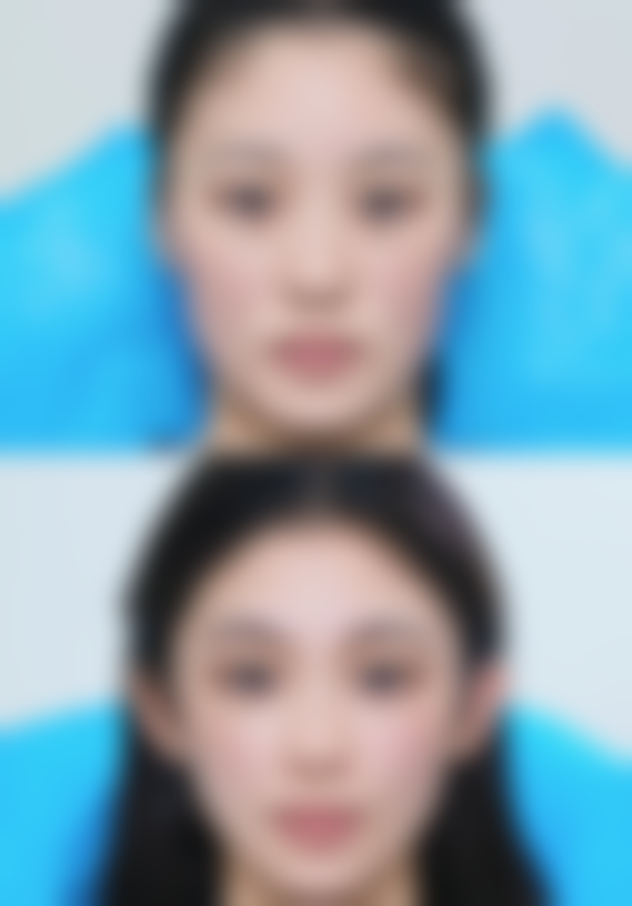 深圳盛美佳整形美容机构口碑评价怎么样?