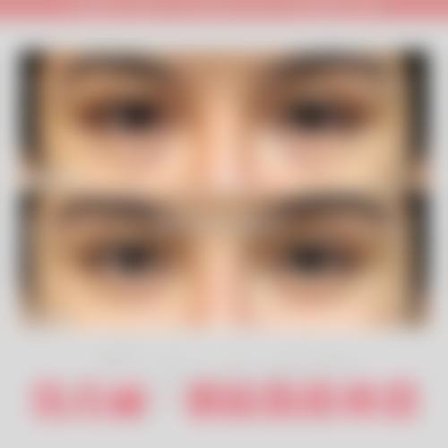 杭州茗悦医疗美容诊所擅长项目。
