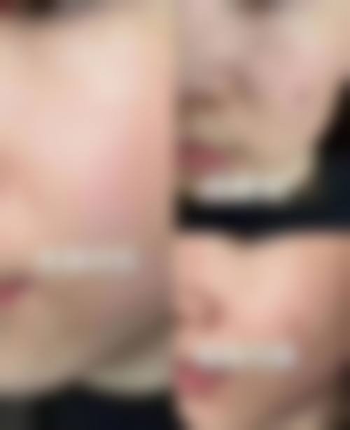 长春爱丽医疗美容门诊部项目优势。