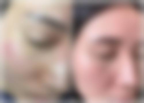 长春爱丽医疗美容门诊部治疗反馈与口碑评价。