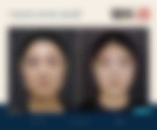 广州柏美医学美容医院2026年价格收费表: