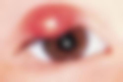 鞍山市中医院眼科擅长项目。