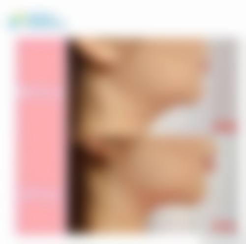 广州法思医疗美容门诊部擅长项目。