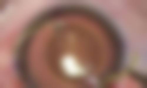吉安市妇幼保健院眼科项目价格。