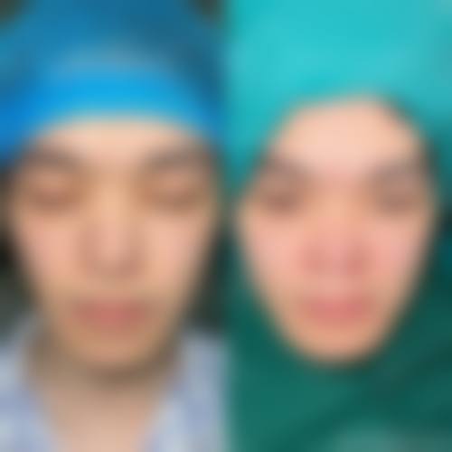 广医二院整形美容科擅长项目。