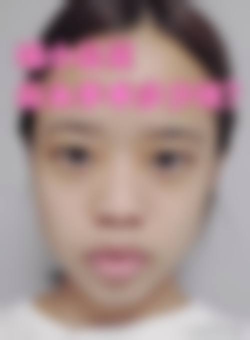 广医二院整形美容科医生团队经验稳定。