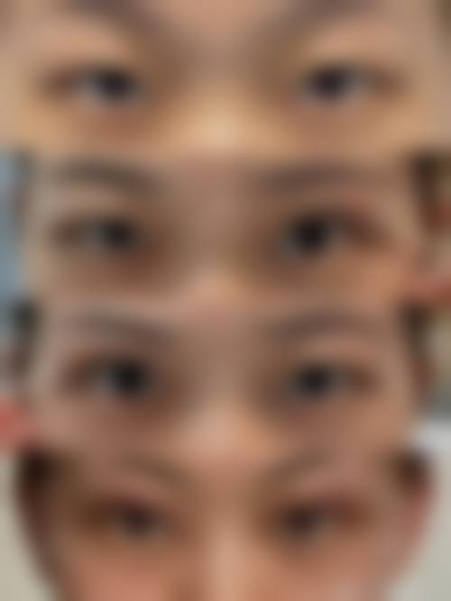 湖南长沙裕湘医院眼科治疗反馈与口碑评价。