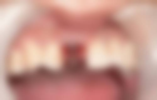 巨野慧齿口腔预约挂号方式。