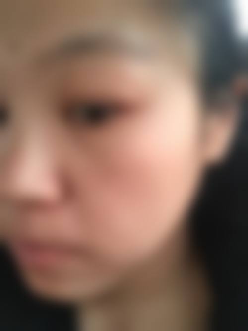 温州林琦整形医院服务理念贴心。