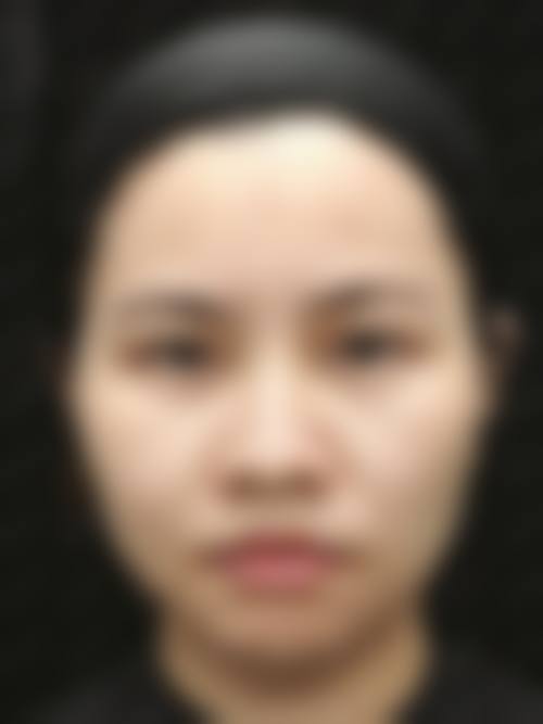 深圳星玮整形医院门诊营业时间