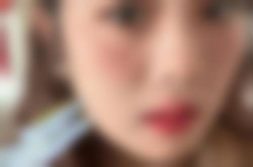 深圳星玮整形医院擅长项目