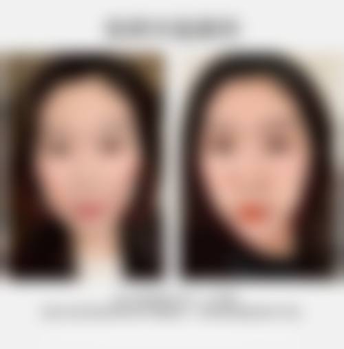 温州林琦整形医院预约挂号方式多样。