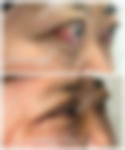 南京博德眼科医院预约挂号方式。