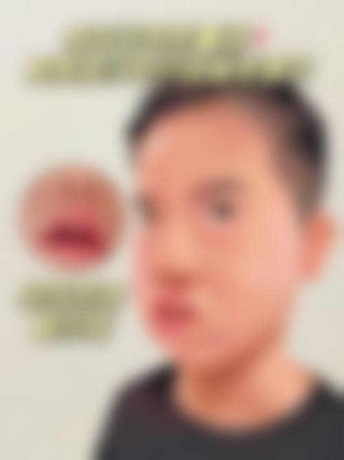 长沙熙美口腔连锁(瑞宁门诊部)治疗反馈与口碑评价。