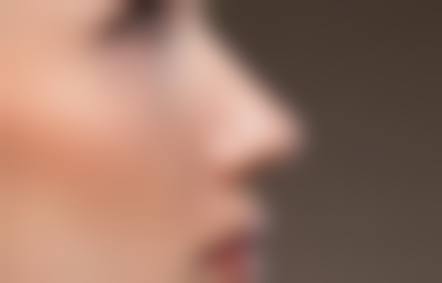 霸州鸿嘉怡美医疗美容门诊部擅长项目。