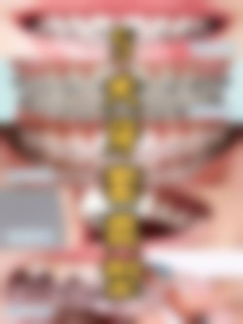 山东淄博玉倩口腔诊所擅长项目。