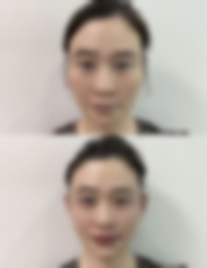 韩国allery皮肤科医生团队经验稳定。