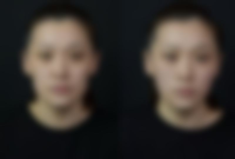 韩国allery皮肤科门诊营业时间。