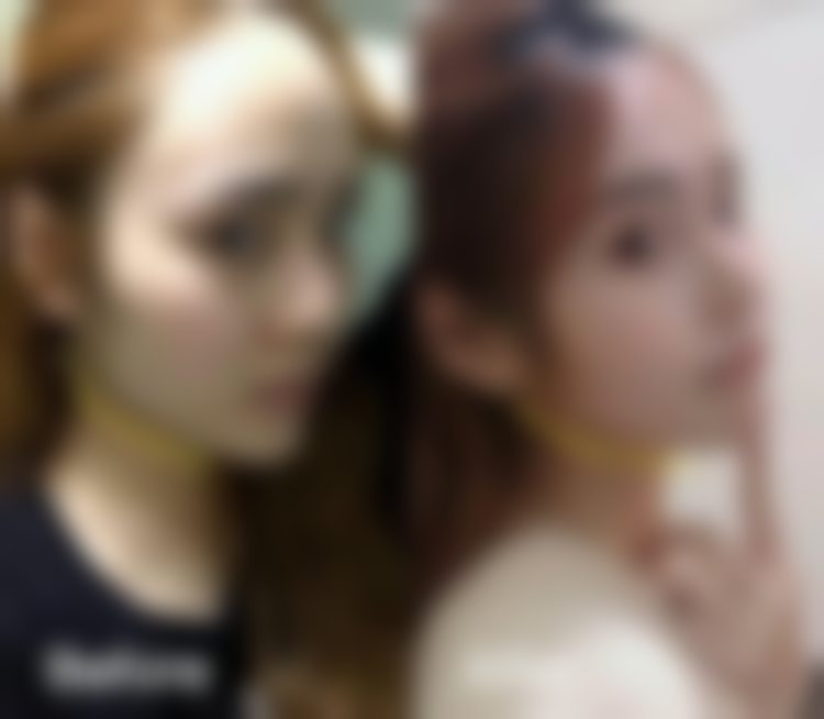 杭州连天美医疗美容医院李大琦:鼻部整形项目