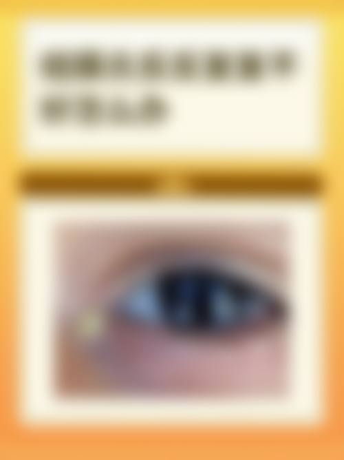 惠州希玛眼科门诊营业时间。