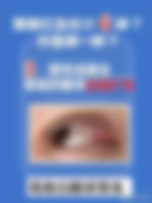 惠州希玛眼科擅长项目。