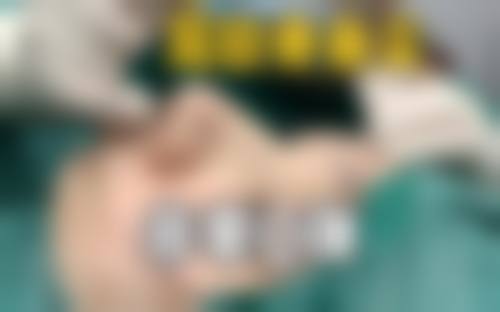 厦门思明海峡整形医疗美容医院擅长项目。