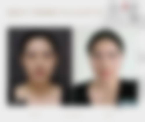 厦门思明海峡整形医疗美容医院治疗反馈与口碑评价。
